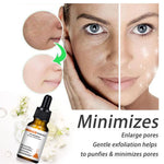 Load image into Gallery viewer, 2022 New Instant Perfection Wrinkles Essence-BUY 2 FREE SHIPPING
