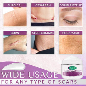 Dermatix-Scar Advanced Removal Cream