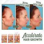 Load image into Gallery viewer, Selling🔥Natural Hair Growth Ginger Cream
