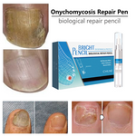 Load image into Gallery viewer, Hot Sale--Onychomycosis Nail Repair Pen (Buy More Get More Free)
