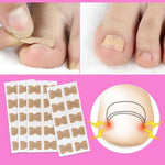 Load image into Gallery viewer, Glue Free Toenail Patch
