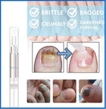 Load image into Gallery viewer, Advanced Fungal Nail Repair Pen
